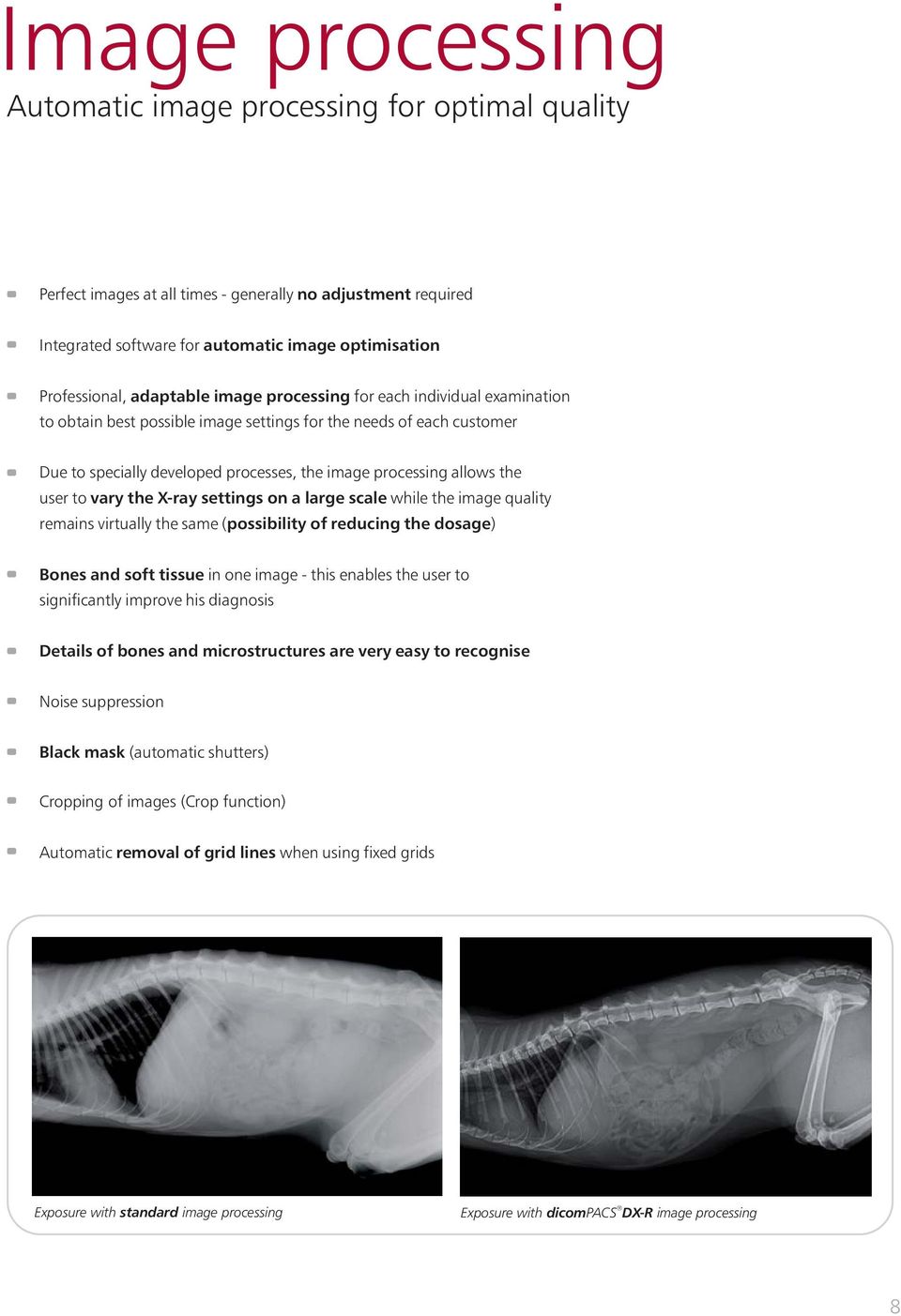 user to vary the X-ray settings on a large scale while the image quality remains virtually the same ( possibility of reducing the dosage) Bones and soft tissue in one image - this enables the user to