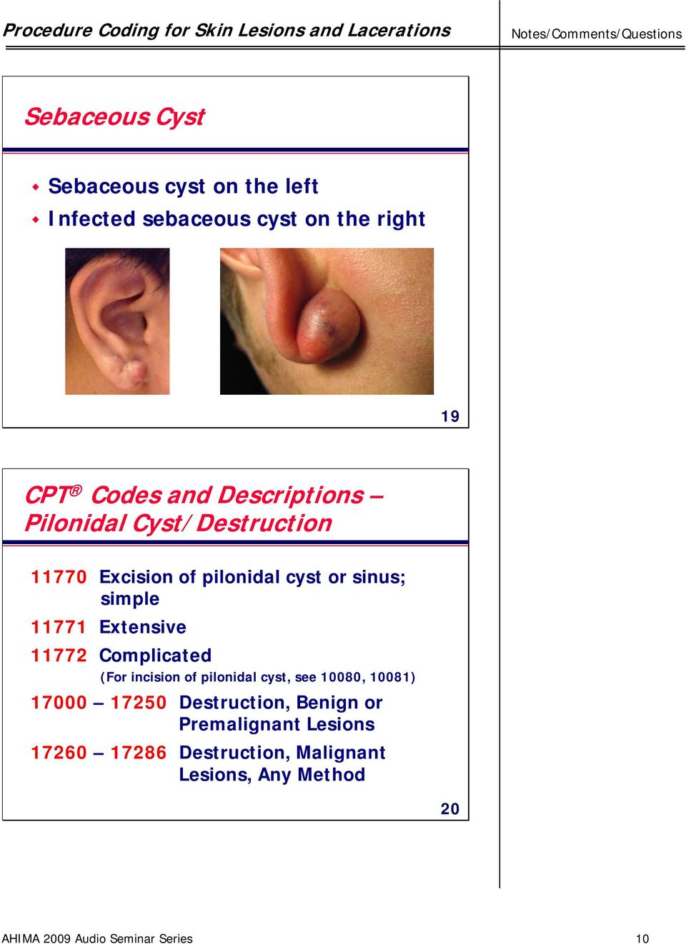 excision of papilloma cpt code)