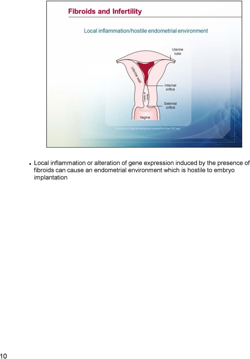 of fibroids can cause an endometrial