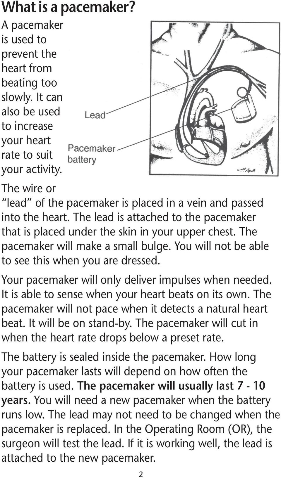 The pacemaker will make a small bulge. You will not be able to see this when you are dressed. Your pacemaker will only deliver impulses when needed.
