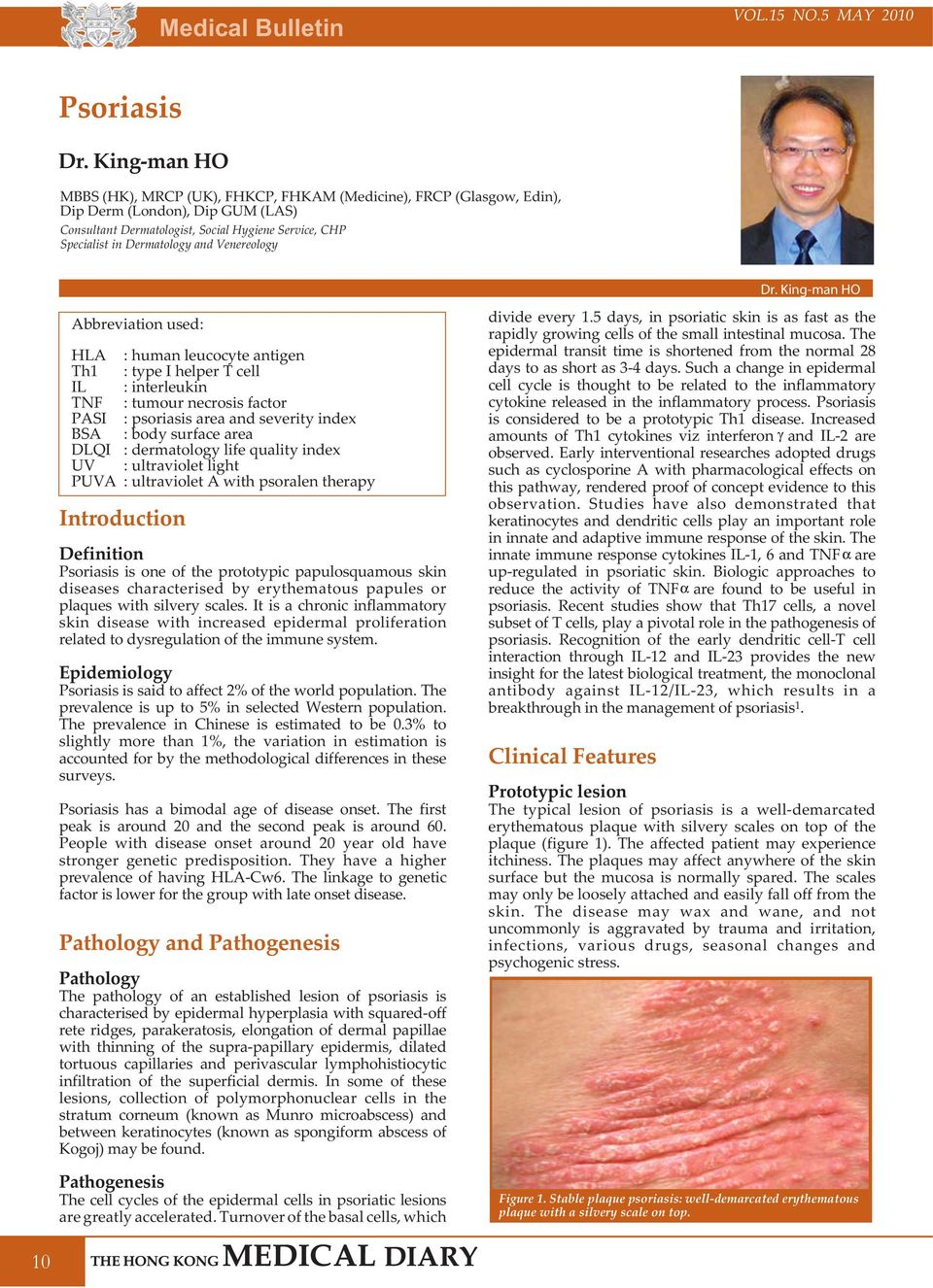 dermatology life quality index UV : ultraviolet light PUVA : ultraviolet A with psoralen therapy Introduction Definition is one of the prototypic papulosquamous skin diseases characterised by