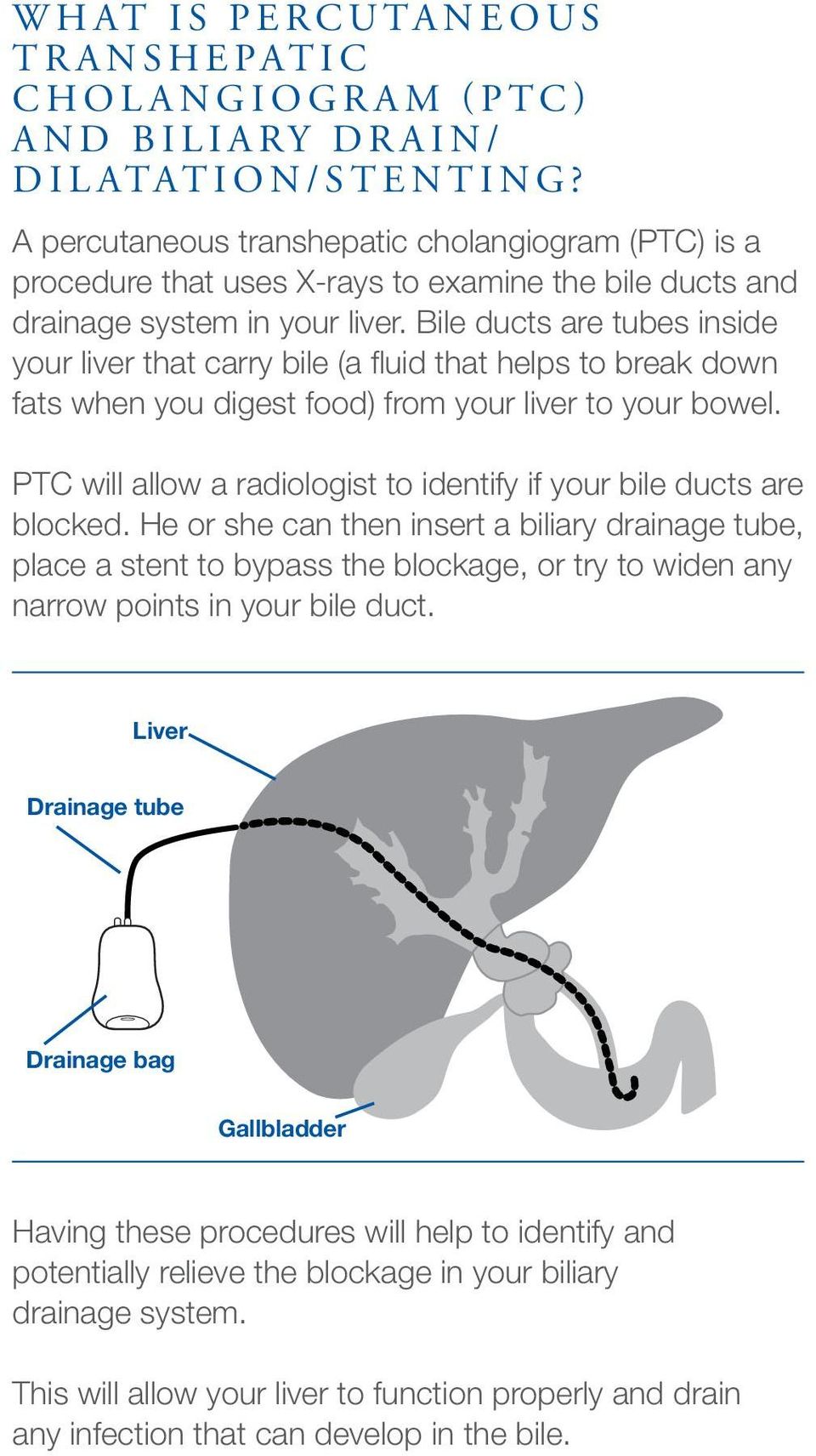 Bile ducts are tubes inside your liver that carry bile (a fluid that helps to break down fats when you digest food) from your liver to your bowel.