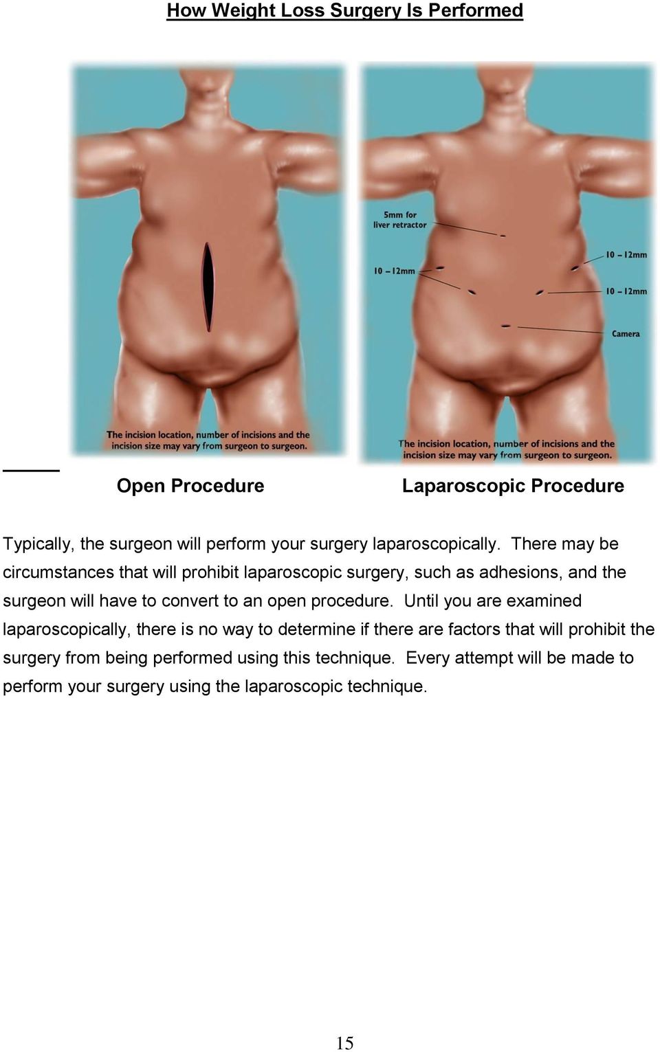 There may be circumstances that will prohibit laparoscopic surgery, such as adhesions, and the surgeon will have to convert to an open