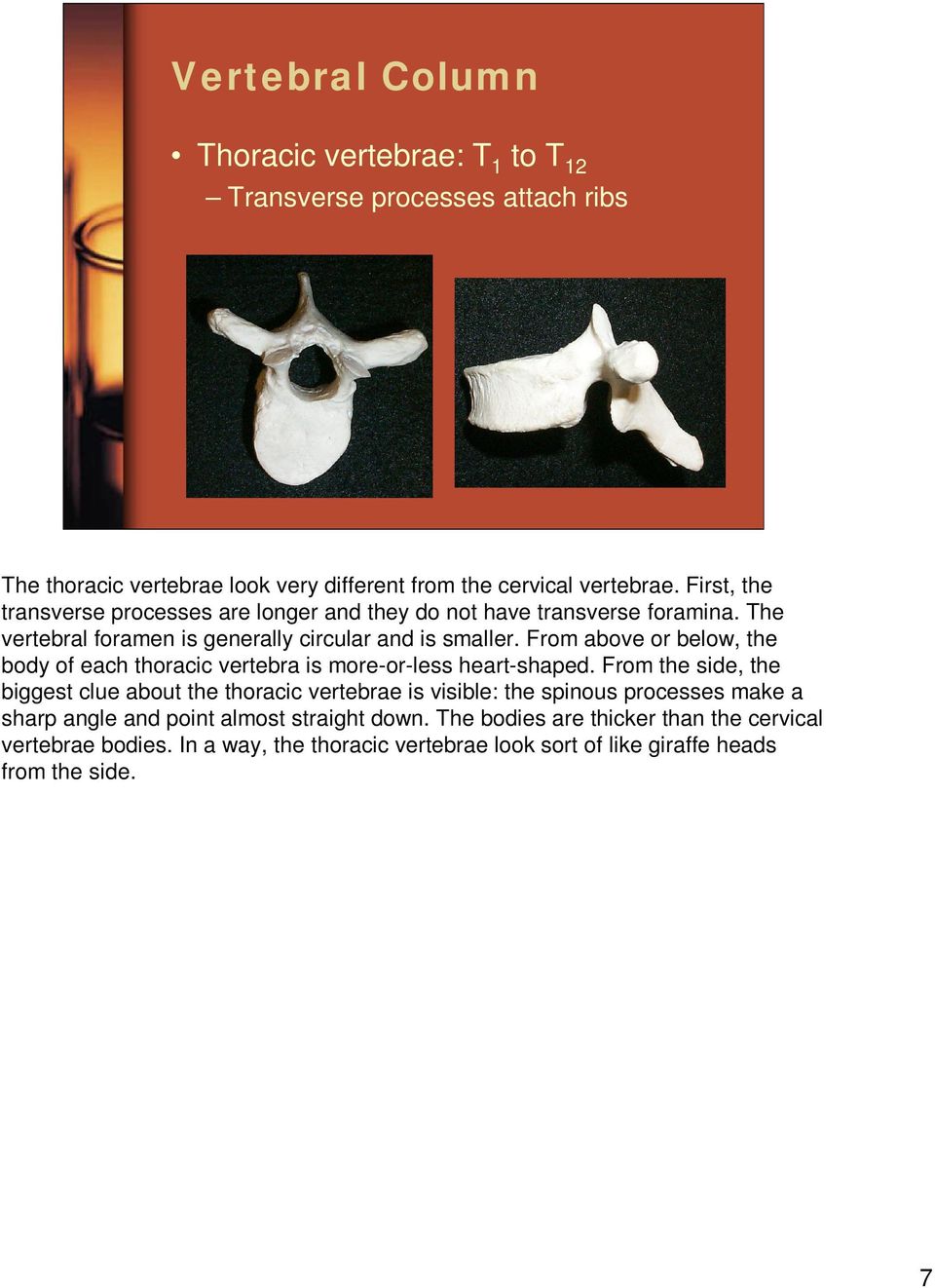 From above or below, the body of each thoracic vertebra is more-or-less heart-shaped.