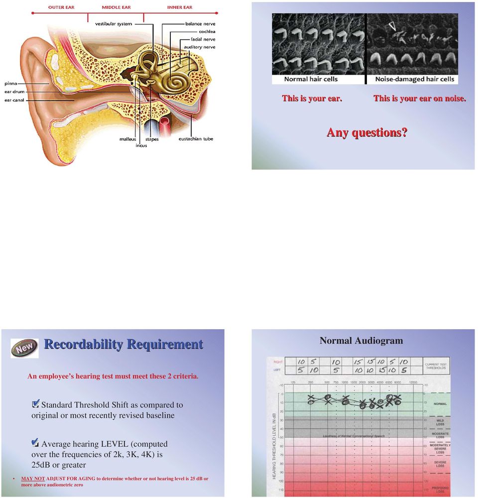 Standard Threshold Shift as compared to original or most recently revised baseline Average hearing LEVEL
