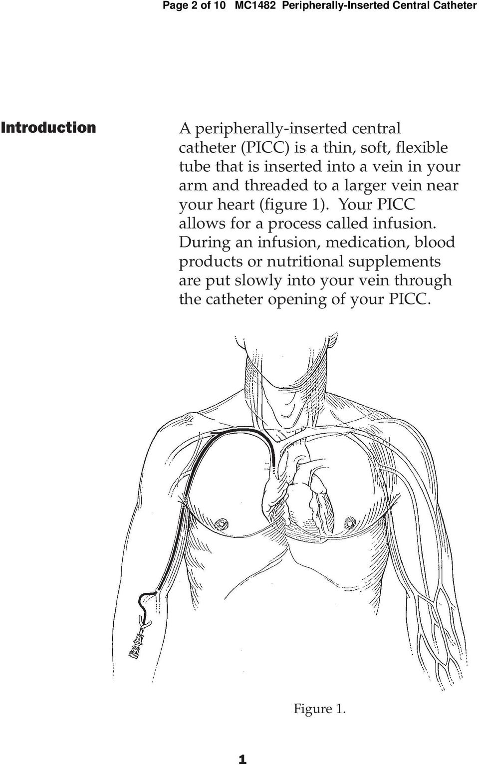 your heart (figure 1). Your PICC allows for a process called infusion.