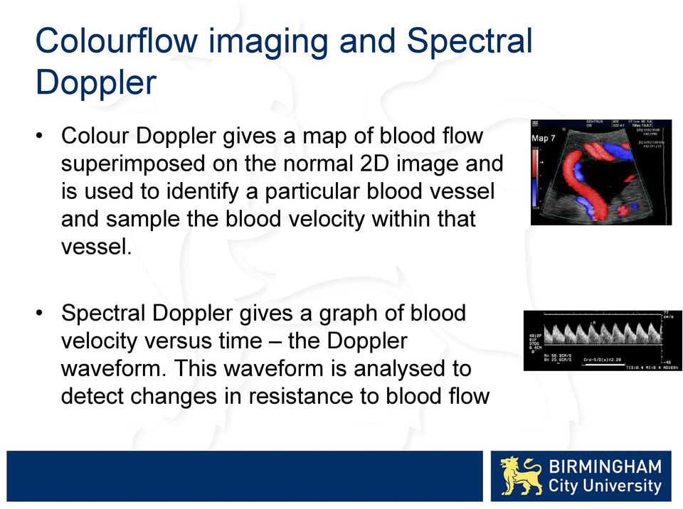 sample the blood velocity within that vessel.