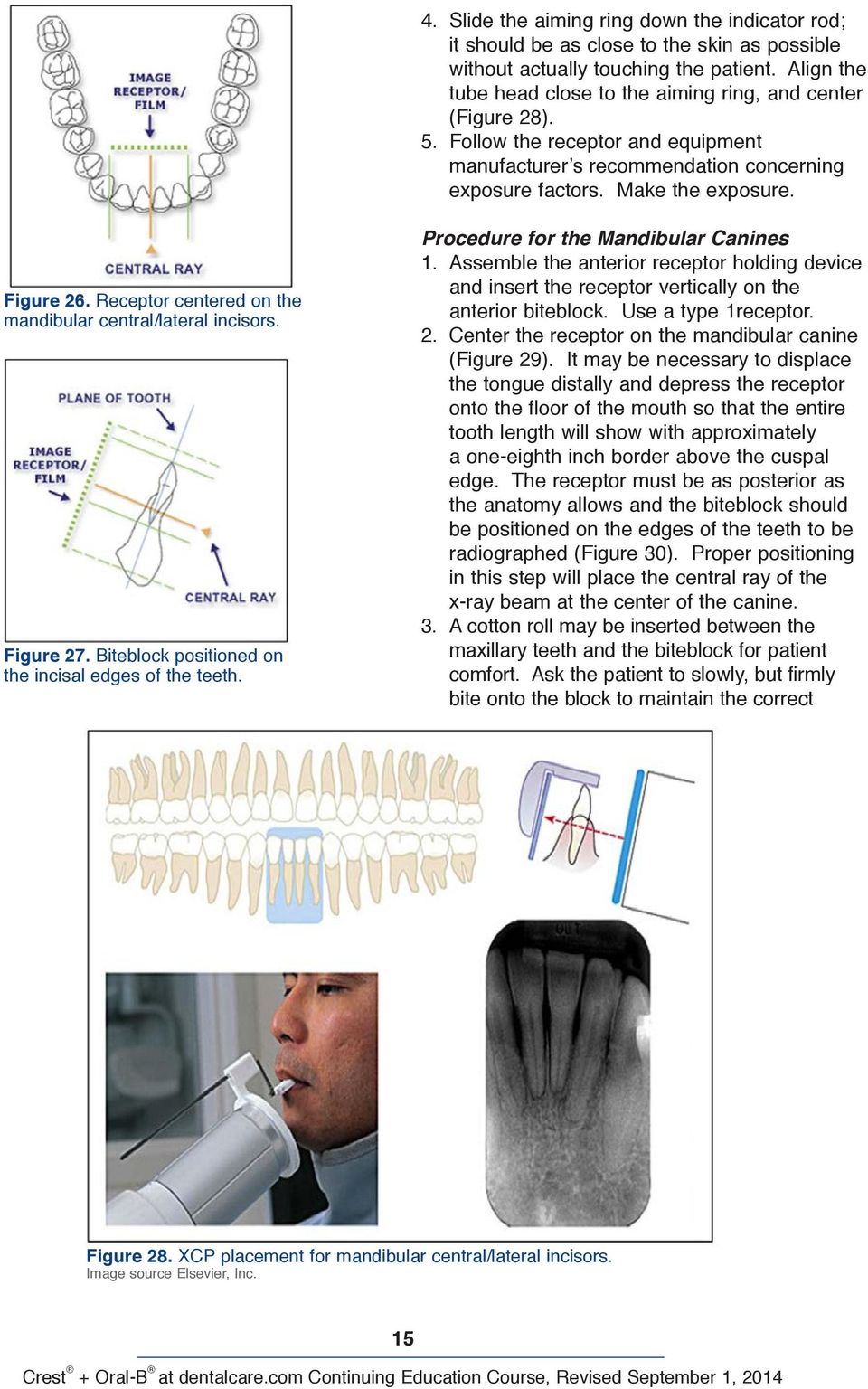 Receptor centered on the mandibular central/lateral incisors. Figure 27. Biteblock positioned on the incisal edges of the teeth. Procedure for the Mandibular Canines 1.