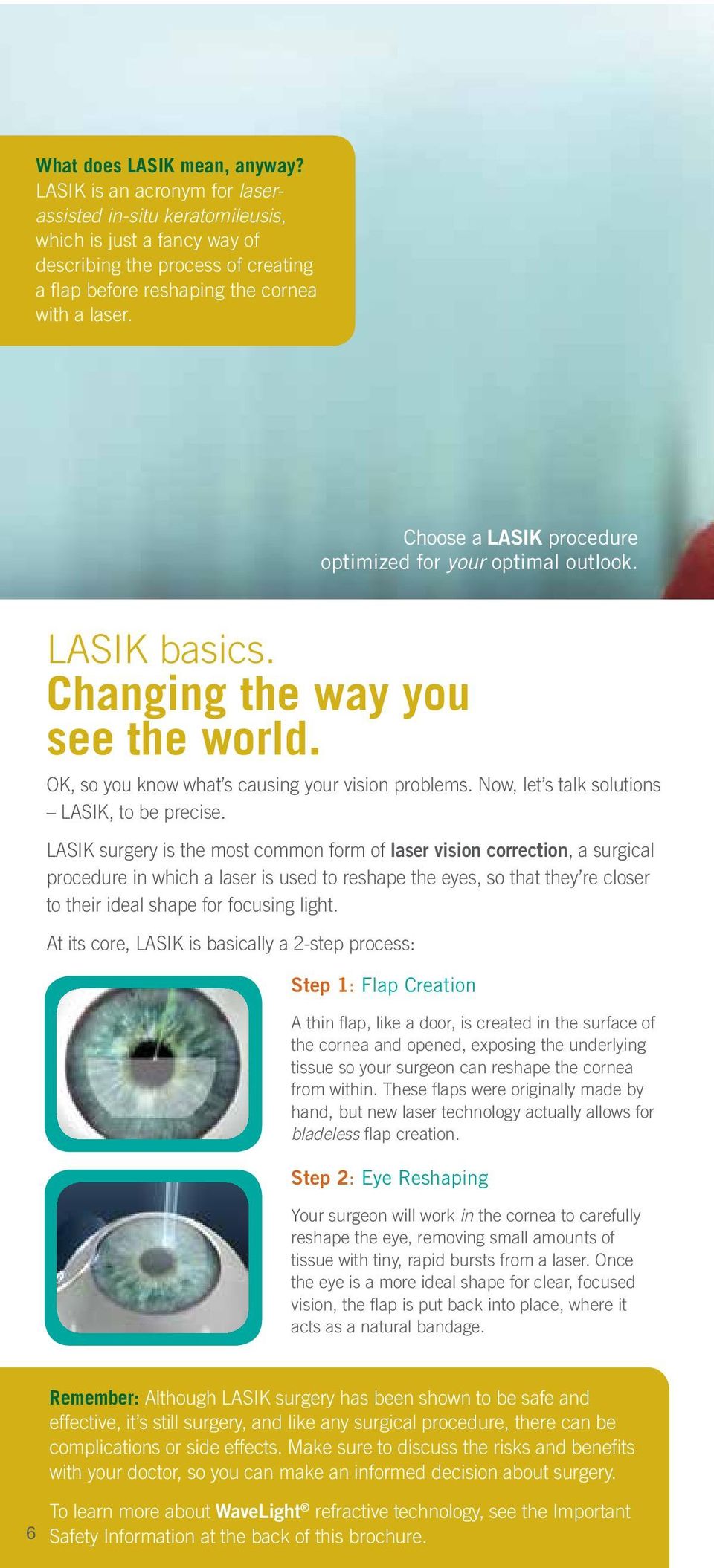 Choose a LASIK procedure optimized for your optimal outlook. LASIK basics. Changing the way you see the world. OK, so you know what s causing your vision problems.