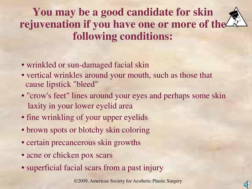 lines around your eyes and perhaps some skin laxity in your lower eyelid area fine wrinkling of your upper eyelids brown