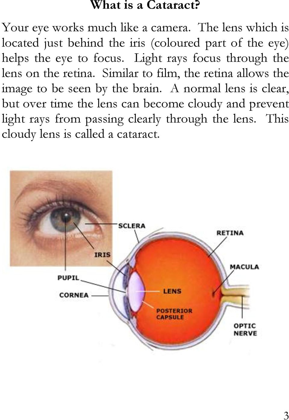 Light rays focus through the lens on the retina.