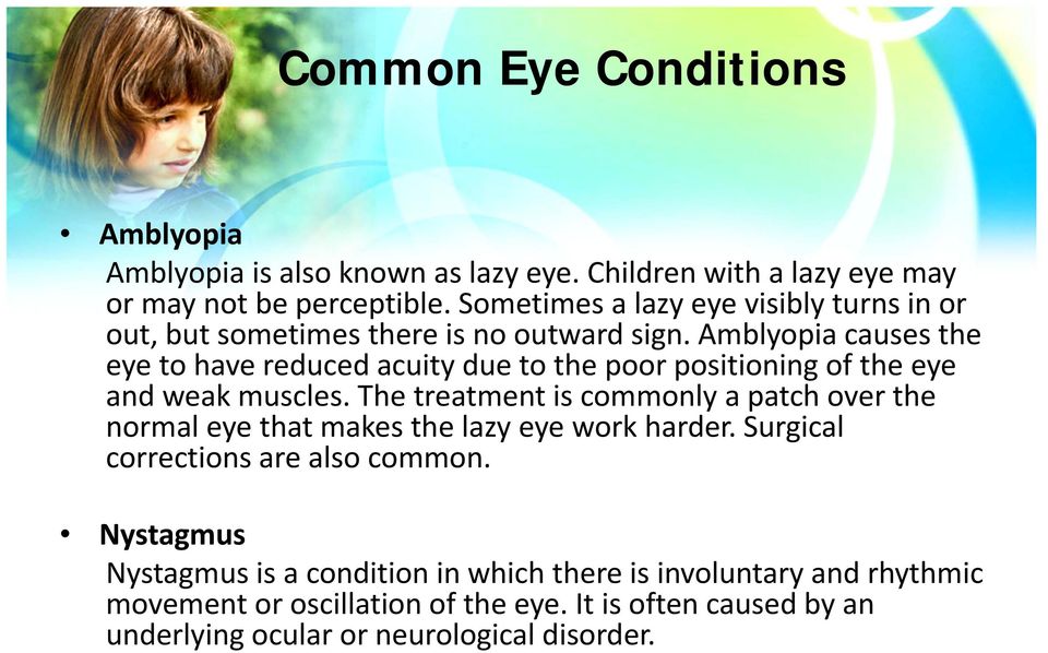 Amblyopia causes the eye to have reduced acuity due to the poor positioning of the eye and weak muscles.