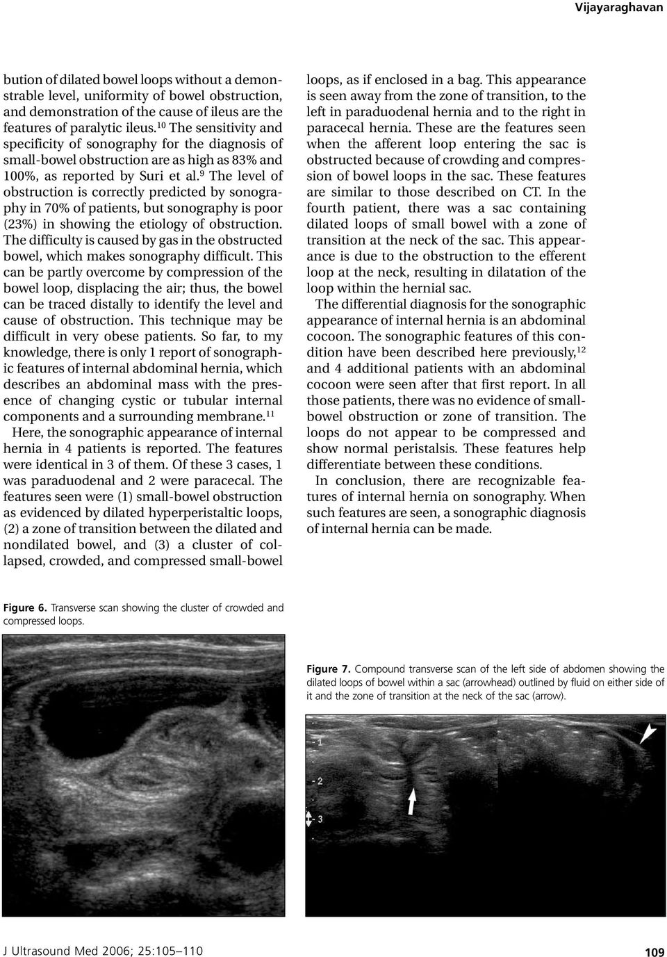 9 The level of obstruction is correctly predicted by sonography in 70% of patients, but sonography is poor (23%) in showing the etiology of obstruction.