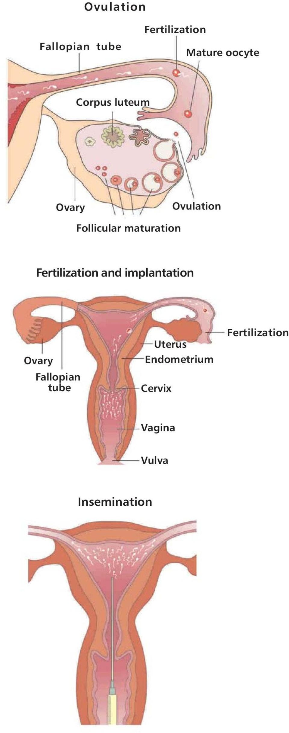 Fertilization and implantation Ovary Fallopian tube