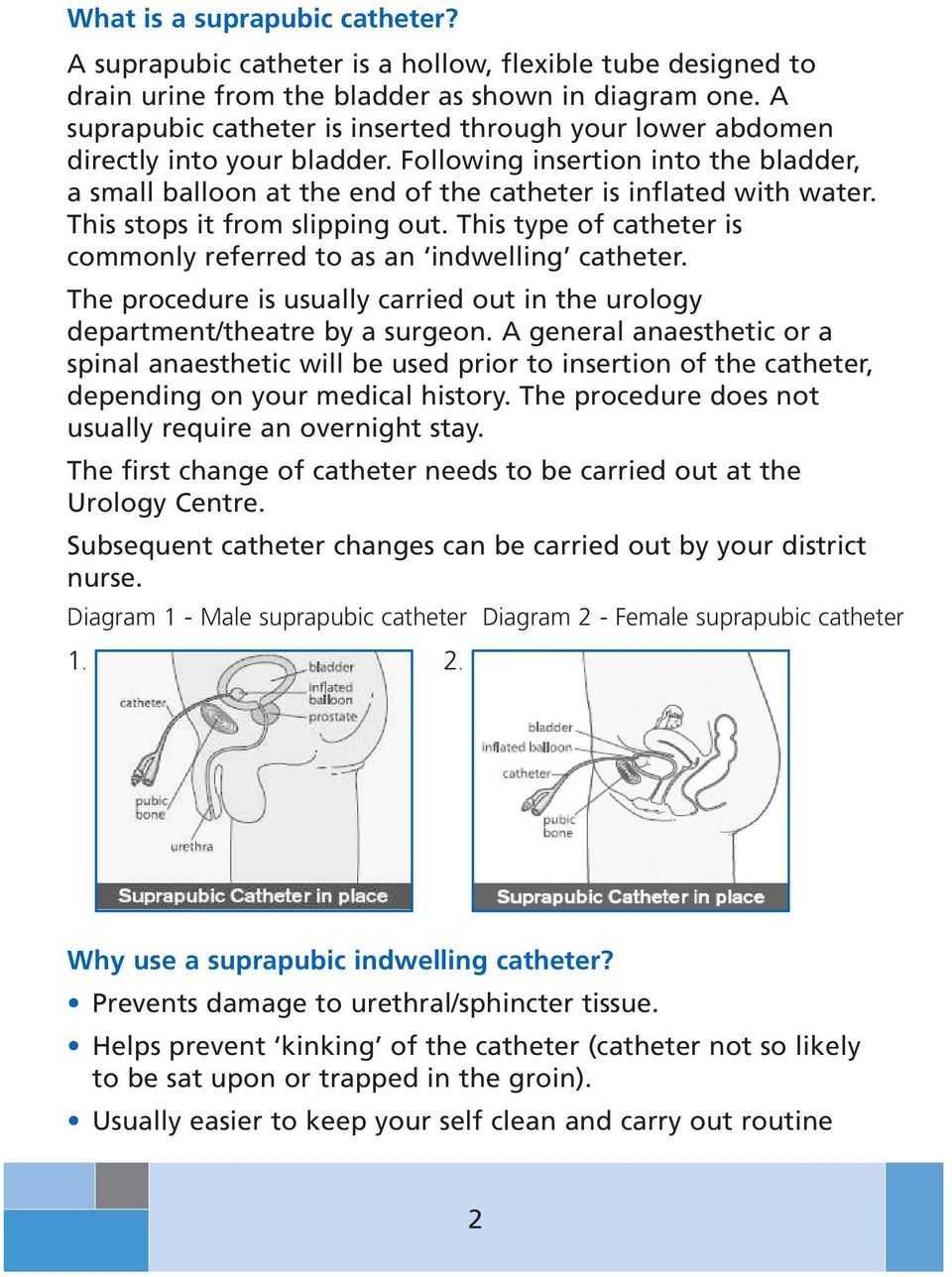 This stops it from slipping out. This type of catheter is commonly referred to as an indwelling catheter. The procedure is usually carried out in the urology department/theatre by a surgeon.