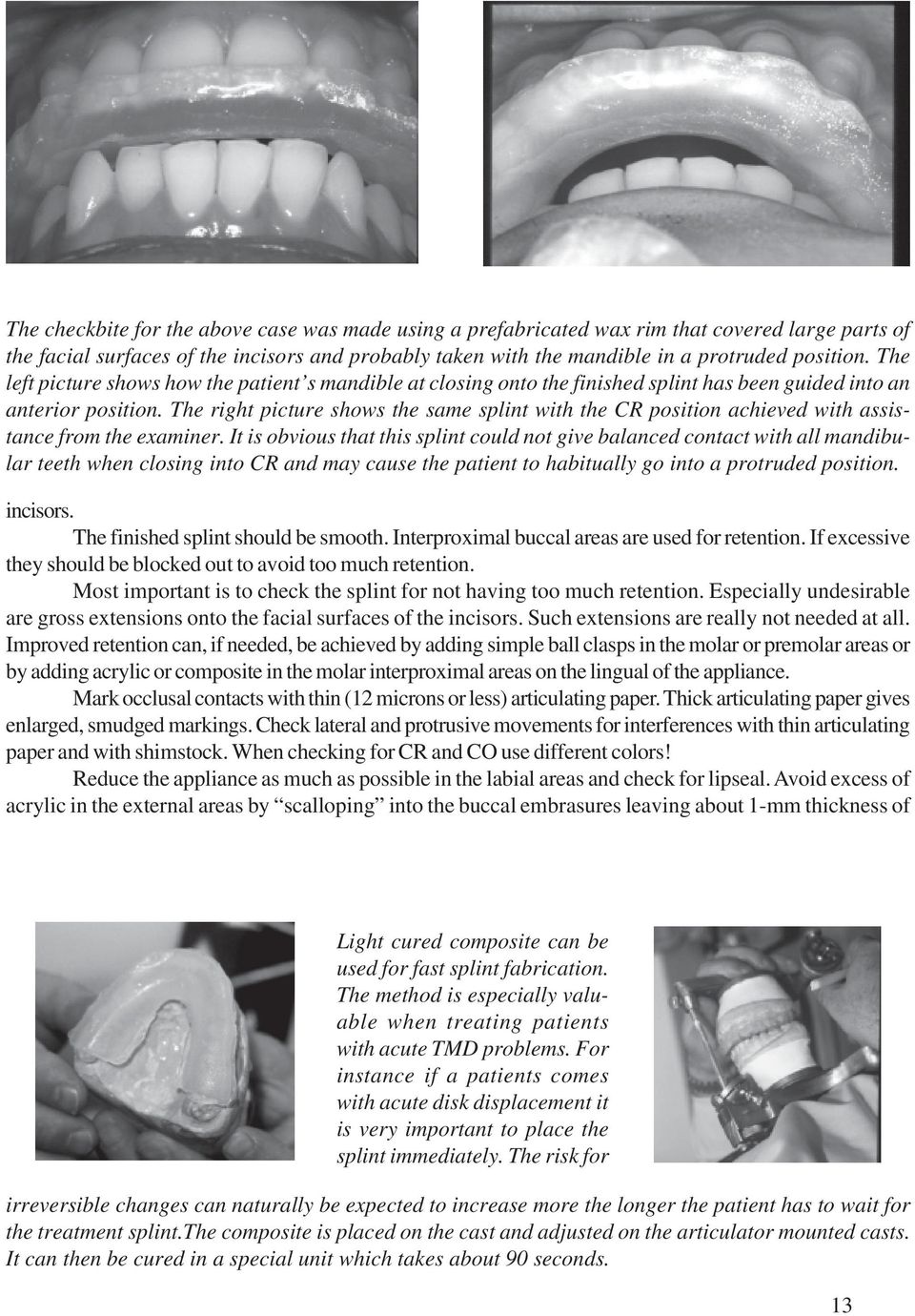 The right picture shows the same splint with the CR position achieved with assistance from the examiner.