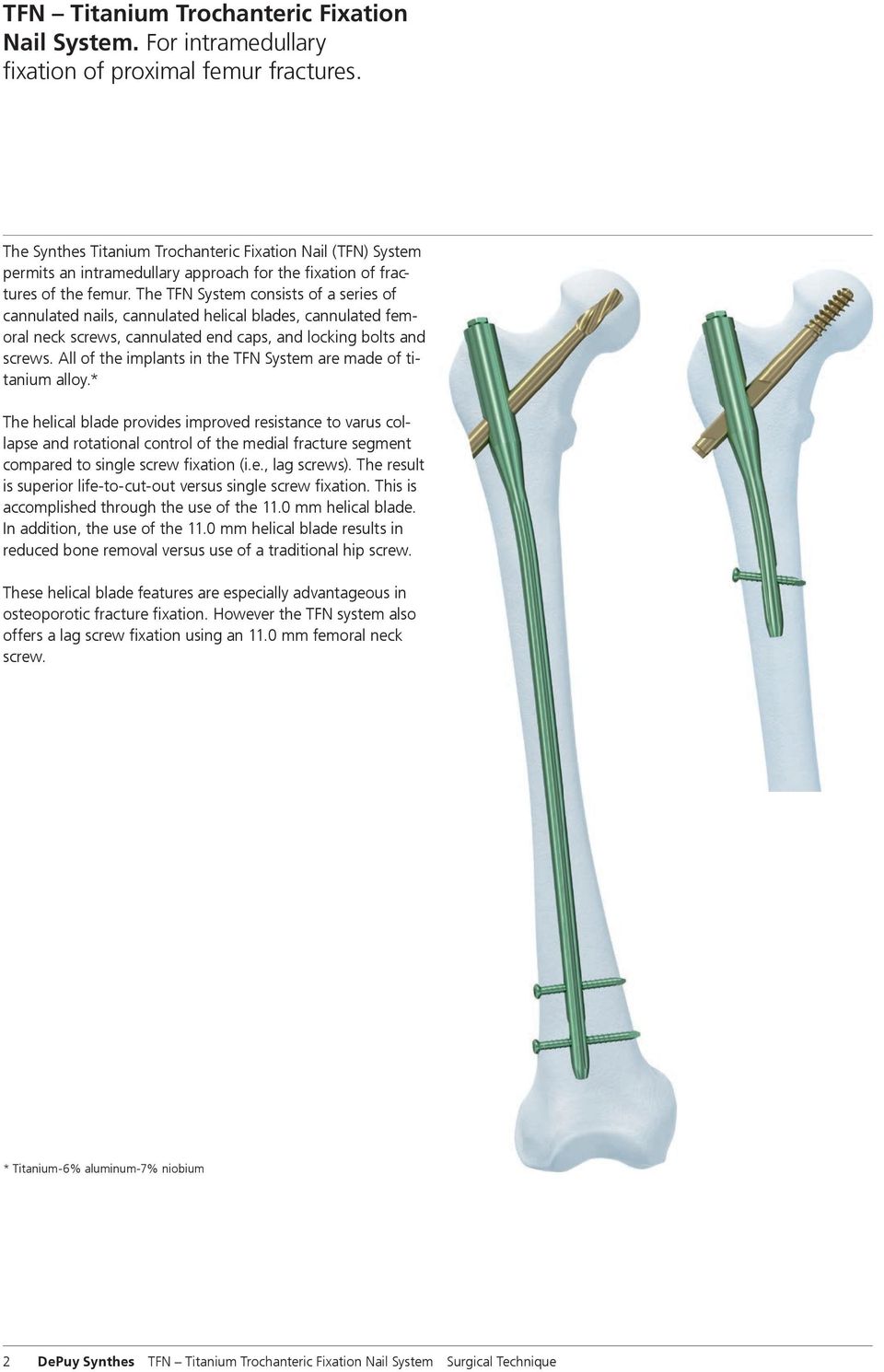 The TFN System consists of a series of cannulated nails, cannulated helical blades, cannulated femoral neck screws, cannulated end caps, and locking bolts and screws.