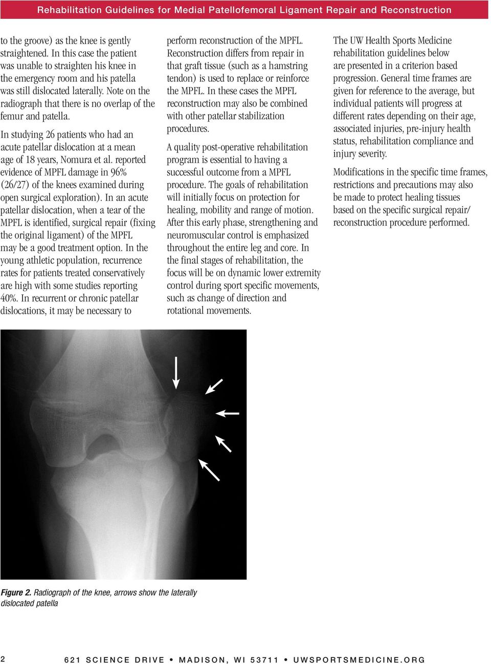 reported evidence of MPFL damage in 96% (26/27) of the knees examined during open surgical exploration).