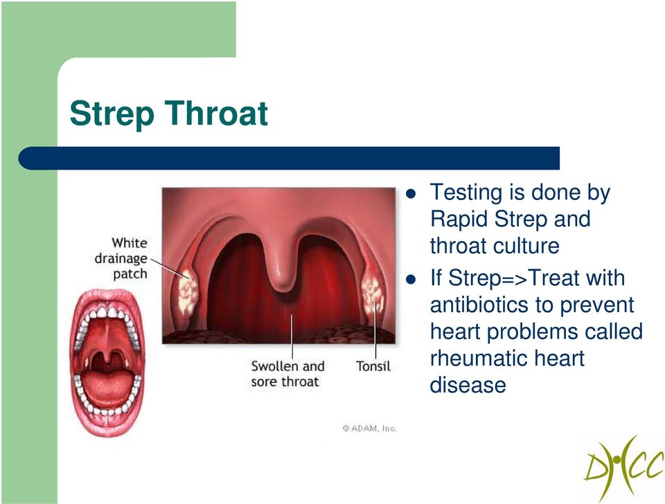 Strep=>Treat with antibiotics to