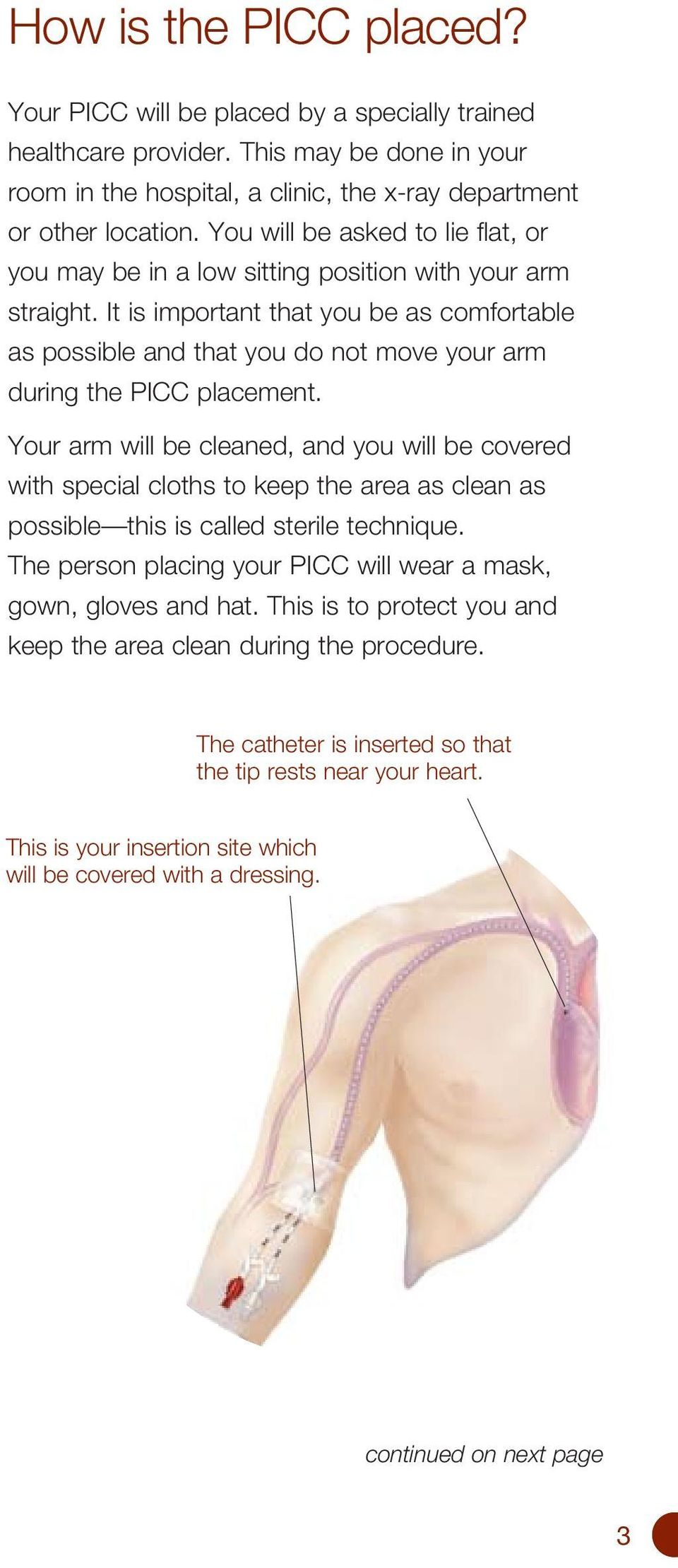 It is important that you be as comfortable as possible and that you do not move your arm during the PICC placement.