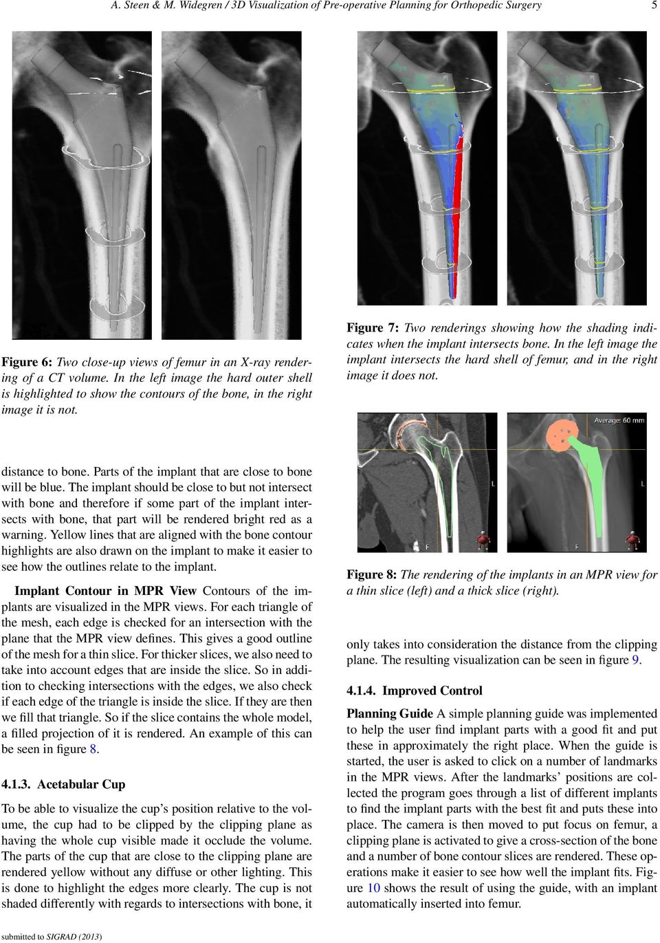 Figure 7: Two renderings showing how the shading indicates when the implant intersects bone. In the left image the implant intersects the hard shell of femur, and in the right image it does not.