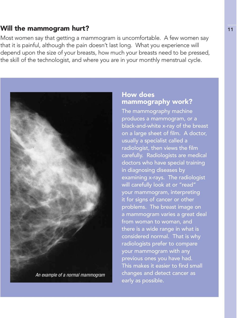 11 An example of a normal mammogram How does mammography work? The mammography machine produces a mammogram, or a black-and-white x-ray of the breast on a large sheet of film.