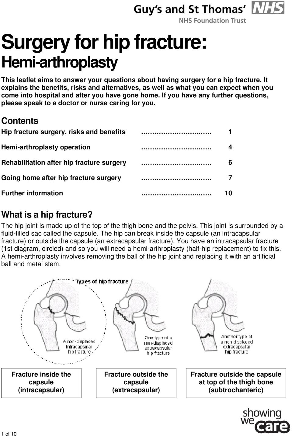 If you have any further questions, please speak to a doctor or nurse caring for you. Contents Hip fracture surgery, risks and benefits.. 1 Hemi-arthroplasty operation.