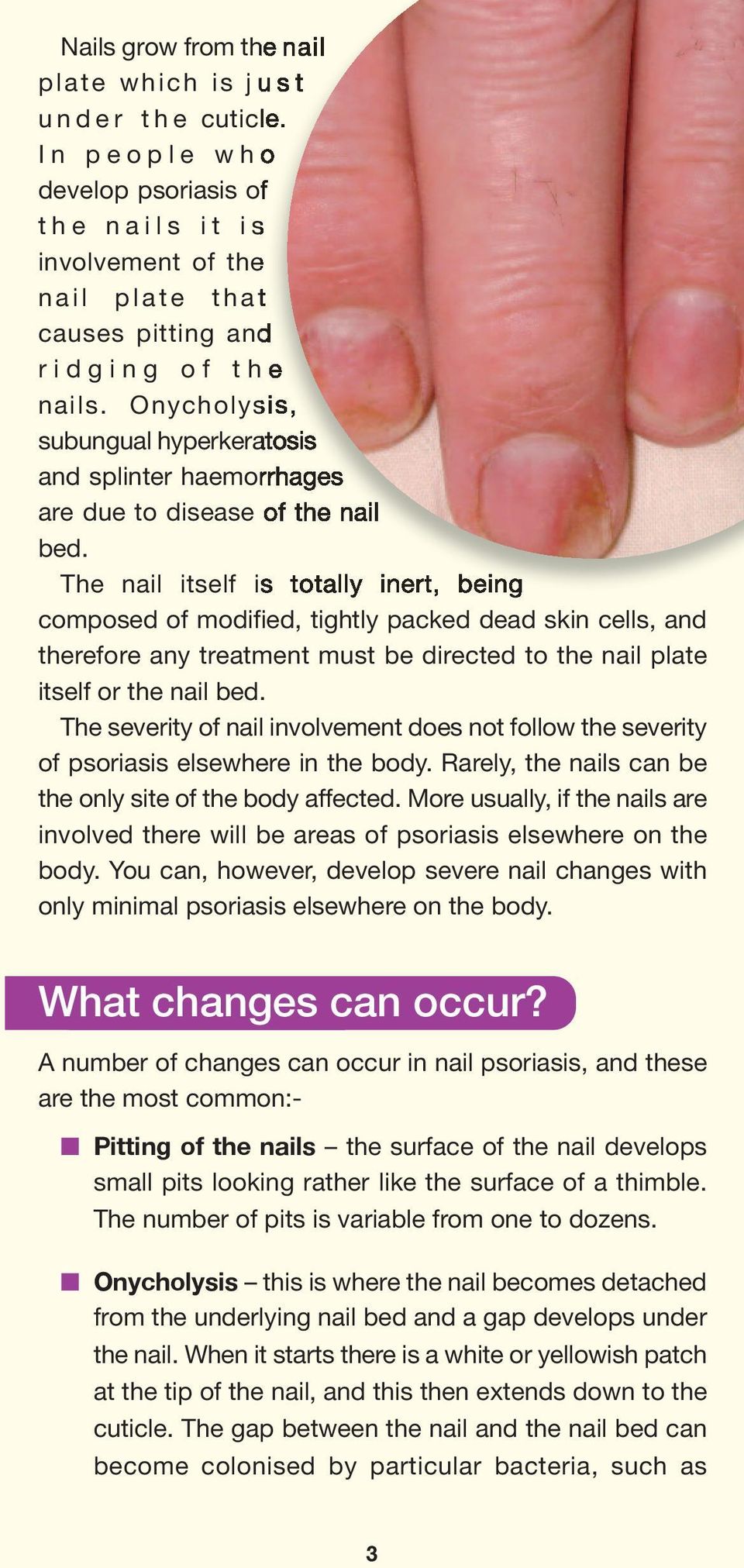 Onycholysis, subungual hyperkeratosis and splinter haemorrhages are due to disease of the nail bed.