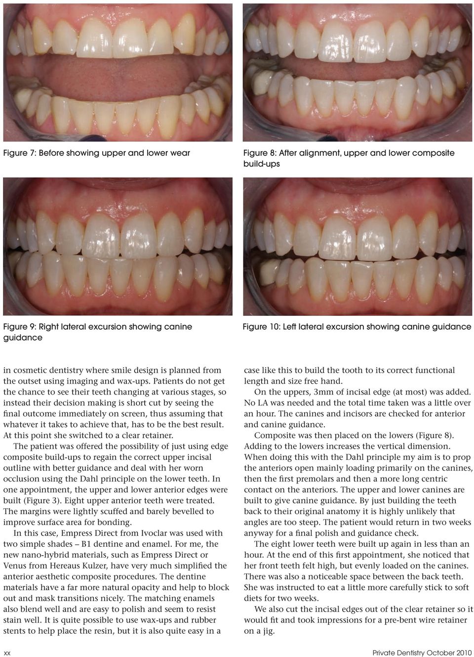Patients do not get the chance to see their teeth changing at various stages, so instead their decision making is short cut by seeing the final outcome immediately on screen, thus assuming that