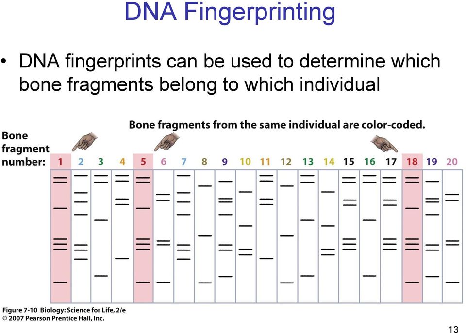 determine which bone