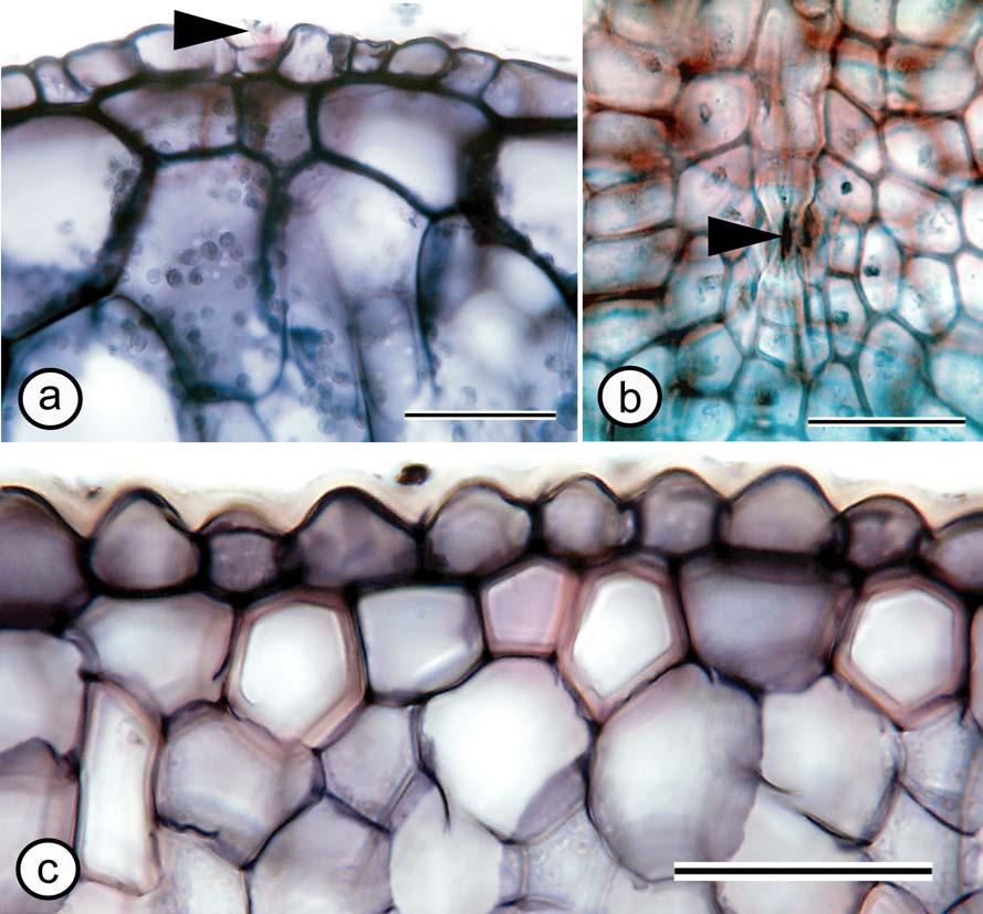 127 Figure 3-16. Leaf sections showing features of the epidermis. a) Aerangis ugandensis TS showing trichome (arrowhead) associated with raised buttress of epidermal cells.