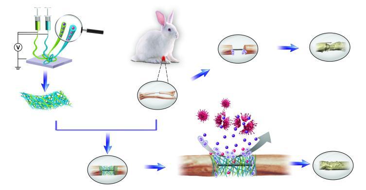 micro/nano fiber membrane with antibacterial and osteogenic dual functions as biomimetic artificial periosteum Rui Shi 1, Min Gong 2, Yuelong Huang 1, Weiyang Li 1, Guangping Li 1, Liqun Zhang 2, Wei
