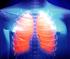 Pulmonary infections are an important cause of morbidity and