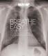BREATHE EASY HOW RADIOLOGY HELPS TO FIND AND FIGHT LUNG DISEASES