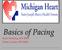 Basics of Pacing. Ruth Hickling, RN-BSN Tasha Conley, RN-BSN
