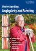 Angioplasty and Stenting