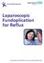 Laparoscopic Fundoplication for Reflux
