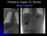 Pediatric Upper GI Series New Patient