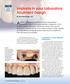 Implants in your Laboratory: Abutment Design