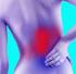 ACUTE LOW BACK PAIN 1