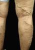 Varicose veins are generally identified