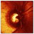 Optic Nerve Imaging. Management of Glaucoma