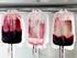 ELECTIVE OUT-OF-HOSPITAL TRANSFUSION: RECOMMENDED CRITERIA AND GUIDELINES FOR TRANSFUSION OF BLOOD COMPONENTS