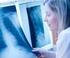 Understanding COPD Questionnaire