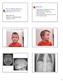Objectives Role of Medical Genetics in Hearing Loss Evaluation. 5 y.o. boy with severe SNHL