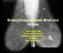 Breast Imaging Made Brief and Simple. Jane Clayton MD Associate Professor Department of Radiology LSUHSC New Orleans, LA