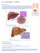 What is Cirrhosis of the Liver?