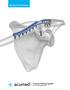 Surgical Technique. Clavicle Plating System Acu-Sinch Repair System