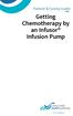 Getting Chemotherapy by an Infusor Infusion Pump