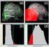 The File-Card-Browser View for Breast DCE-MRI Data